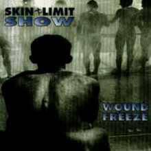 Skin Limit Show : Wound Freeze